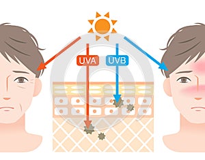 Diagram of uva and uvb  penetration into human skin with manÃ¢â¬â¢s face. Beauty and health care concept photo