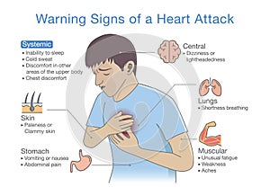 Diagram about warning signs of a heart attack.