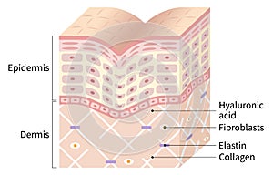 Diagram of winkle skin. the collagen framework is broken and wrinkles appears. Beauty skin care concept