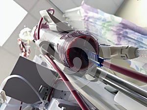 Dialysis Machine with Tubing and Dialyzer