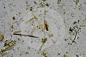 diatom and water microorganisms under the microscope