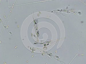 Diatoms, algae under microscopic view, phytoplankton, fossils, silica, golden yellow algae