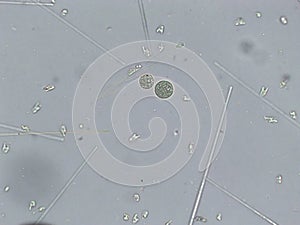 Diatoms, algae under microscopic view, phytoplankton, fossils, silica, golden yellow algae