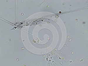 Diatoms, algae under microscopic view, phytoplankton, fossils, silica, golden yellow algae