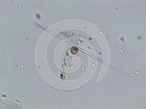 Diatoms, algae under microscopic view, phytoplankton, fossils, silica, golden yellow algae