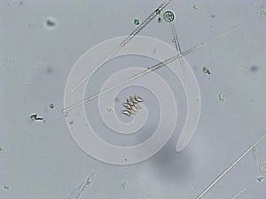 Diatoms, algae under microscopic view, phytoplankton, fossils, silica, golden yellow algae