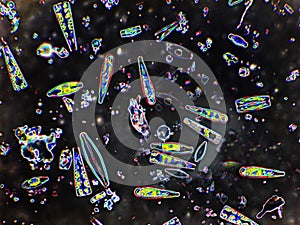 Diatoms dcc 400X