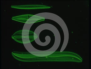 Diatoms from the sea