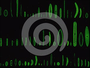 Diatoms from the sea under the microscope