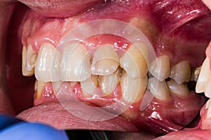 DIdactic exaples of dental problems