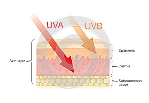 The difference of radiation types in sunlight with skin.