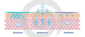 The differences between occlusives, humectants and emollients on skin layer. photo