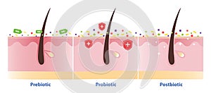 The differences between prebiotic, probiotic and postbiotic on skin.