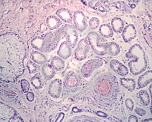 Differences between sebaceous and apocrine sweat glands