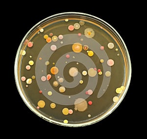 Different bacterial colonies on petri dish isolated on black background