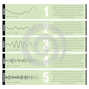 Different brain waves diagrams