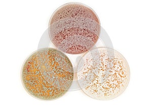 Different fungi microorganisms on agar plate photo