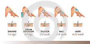 Different methods of hair removal. Shaver, depilatory cream, epilator, wax and laser. Types of epilation with timeline actions photo