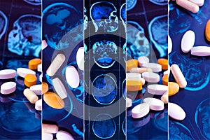 Different pharmaceutical medicine pills on magnetic brain resonance scan mri background collage. Pharmacy theme, health care