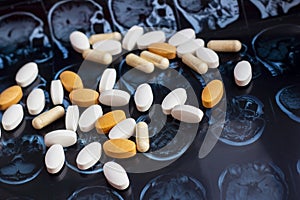 Different pharmaceutical medicine pills on magnetic brain resonance scan mri background. Pharmacy theme, health care