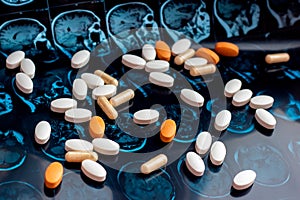 Different pharmaceutical medicine pills on magnetic brain resonance scan mri background. Pharmacy theme, health care