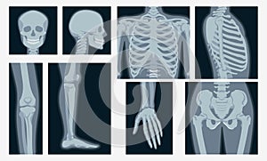 Different x-rays shot of human body part set vector flat illustration