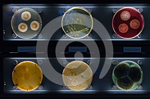 Different samples with kinds of bacterias living at common household items. penicillium citrinum, staphylococcus aureus,