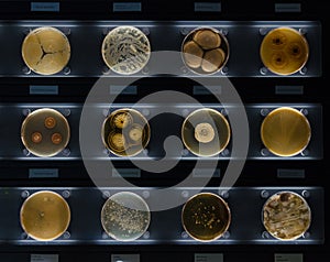 Different samples with kinds of bacterias living at common items- bus button, broom, doorknob, newspaper. Penicillium isarifforme