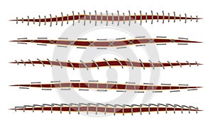 Different Surgical Stitches Isolated On White Background Vector Set