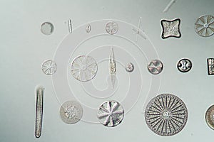 different types of diatoms, photo