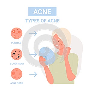 Different types of facial skin acne