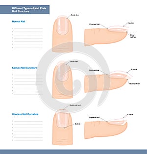 Different Types of Nail Plate. Normal, Convex and Concave Nails. Nail Extension Guide. Vector