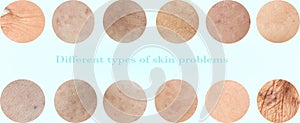 Different types of skin problems