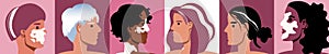 Different women with vitiligo skin as collage, flat vector stock illustration with depigmentation appearance