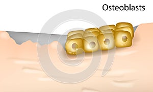 Differentiation of Primary Human Osteoblasts cells.