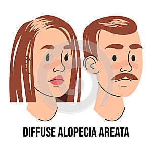 Diffuse alopecia areata disease vector isolated