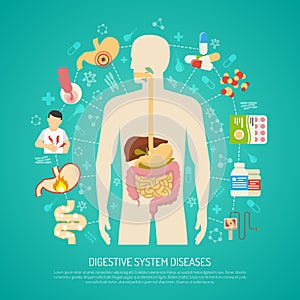 Digestive System Diseases Illustration