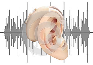 Digital hearing aid behind the ear, on the background of sound wave diagram. Treatment and prosthetics of hearing loss