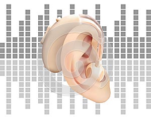 Digital hearing aid behind the ear, on the background of sound wave diagram. Treatment and prosthetics of hearing loss