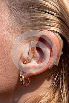 Digital hearing aids