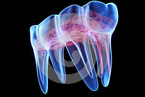 Digital illustration of molar tooth in blue colour isolated on black background, 3d render of jaw x-ray with aching tooth, AI