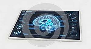 Digital Tablet Displaying Brain Analysis and Artificial Intelligence Interface
