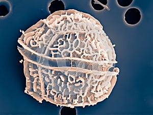 dinoflagellate photographed with the electron microscope