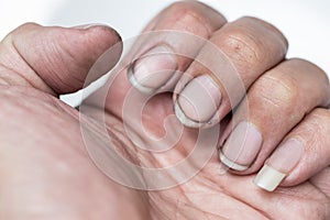 Dirty finger nails unhealthy pile up germ and bacteria unclean photo
