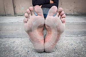 Dirty foot of a man sitting on concrete floor.