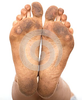 Dirty foot on a white background