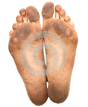Dirty foot on a white background