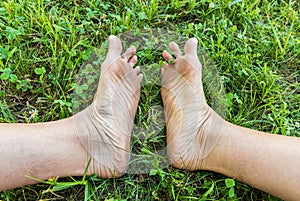 Dirty soles of the adult feet on the green grass