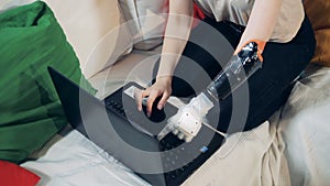 Disabled girl with prosthetic hand works with a laptop, close up.