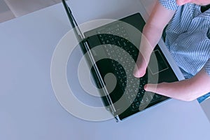 Disabled man with amputated stump hands is typing on laptop, closeup top view.